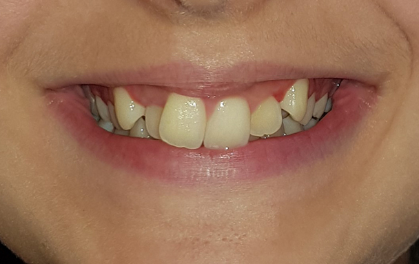 Before image