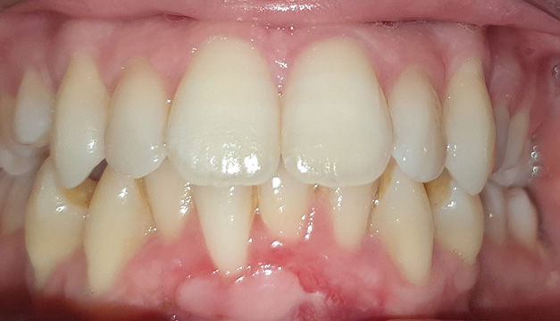 Before image