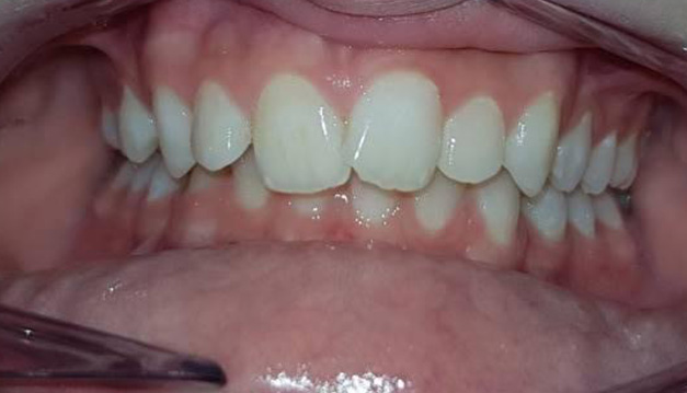 Before image